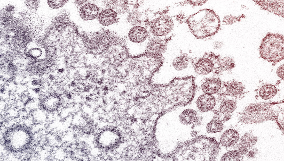 microscopic image of COVID-19 pathogen