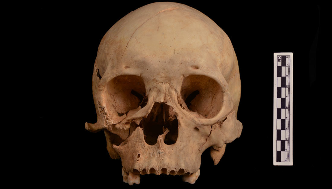 The skull of a 1,300-year-old murder victim, discovered in an old grave robber’s shaft in China.