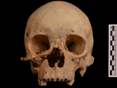 The skull of a 1,300-year-old murder victim, discovered in an old grave robber’s shaft in China.