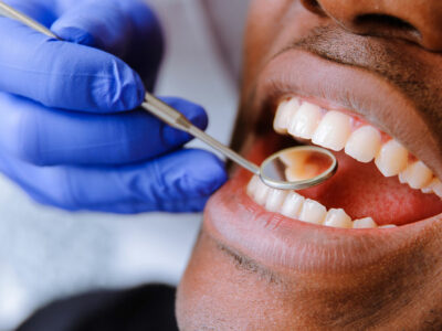 Male patient getting dental treatment in dental clinic
